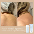 Clarifying Body Routine by juno&me, before and after 30 days of use