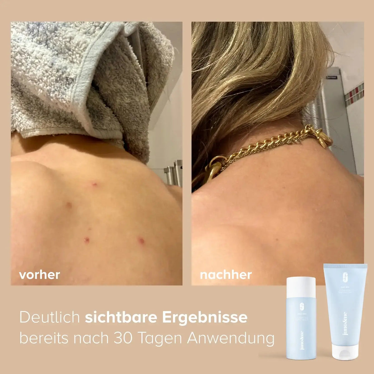 Clarifying Body Routine von juno&me: Hautbild vorher und nach 30 Tagen Anwendung