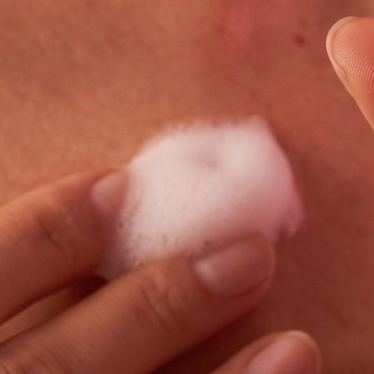 Lactic acid moisturises and regulates the pH value
