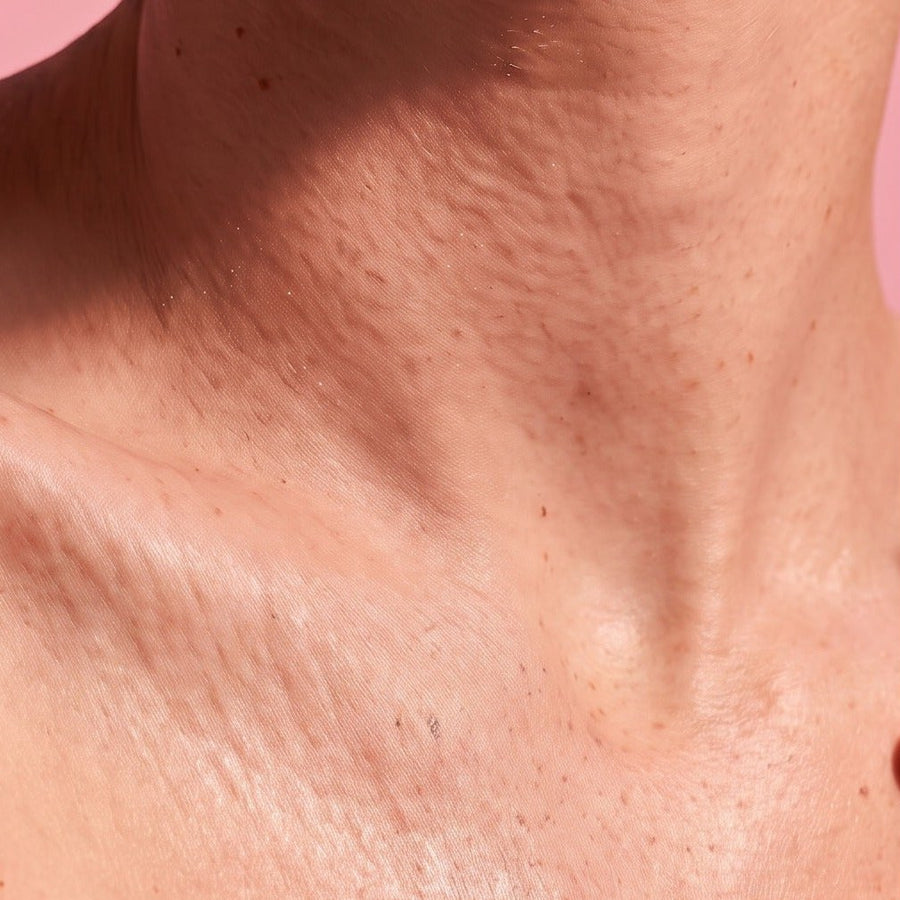 Dry skin